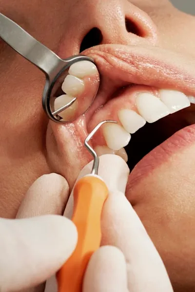 Patient smiling after dental treatment