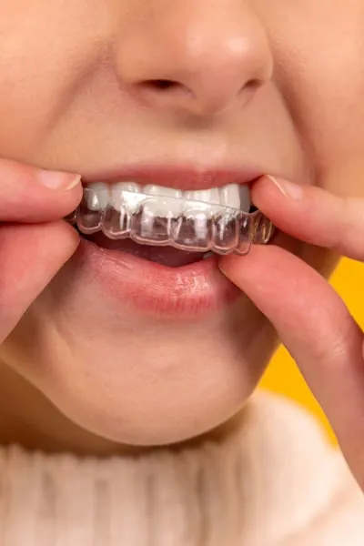 Close-up of healthy smile