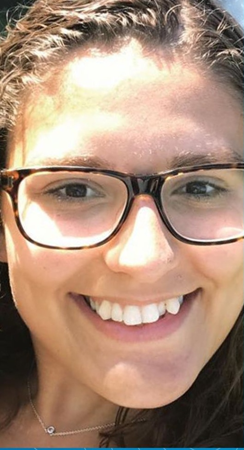INVISALIGN CLEAR ALIGNERS Before